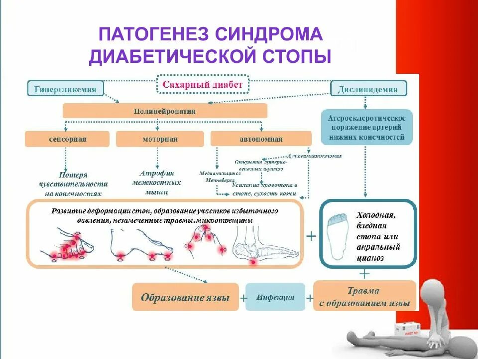 Диабетическая стопа патогенез. Патогенез диабетической стопы при сахарном диабете. Патогенез формирования диабетической стопы. Синдром диабетической стопы патогенез.