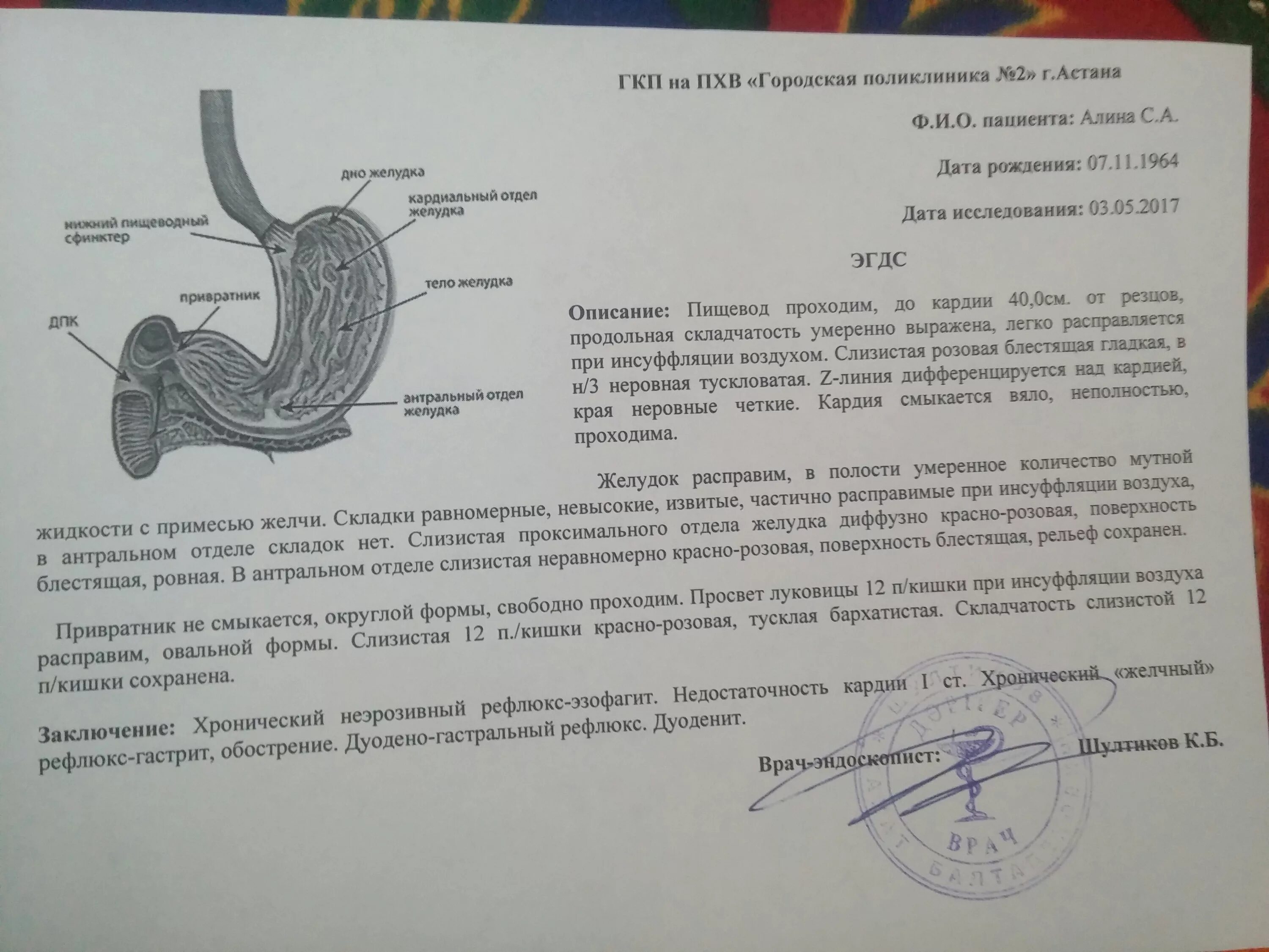Эзофагогастродуоденоскоп используется для осмотра слизистой оболочки