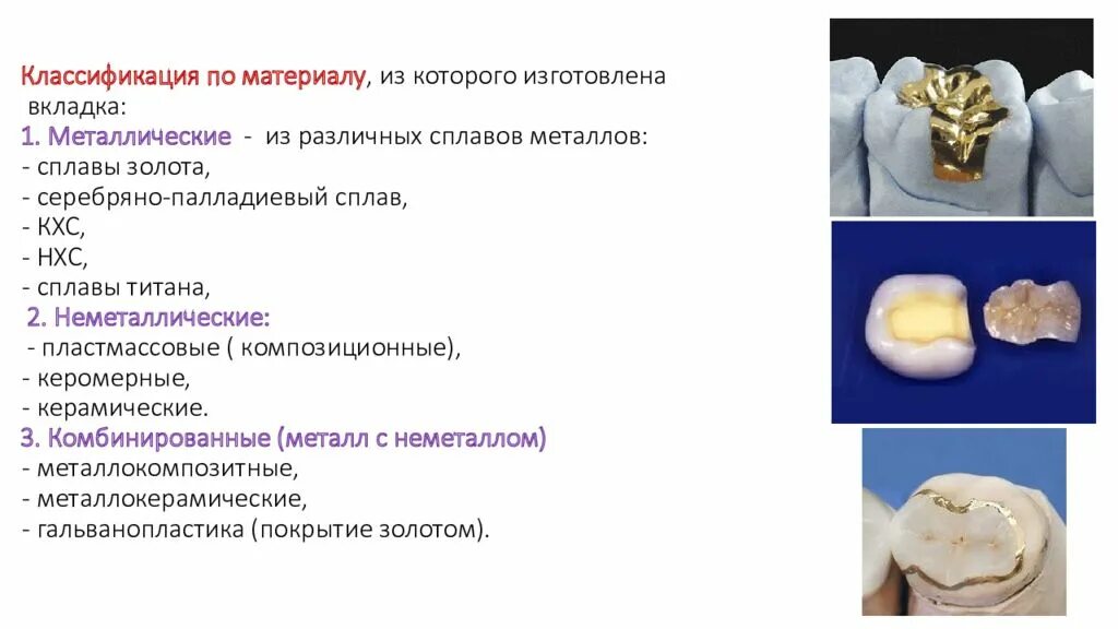 Прямой метод изготовления вкладок. Микропротезы несъемные. Керамическая вкладка на зуб. Вкладки материалы. Вкладки материалы.