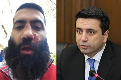 Есть ли у армян
