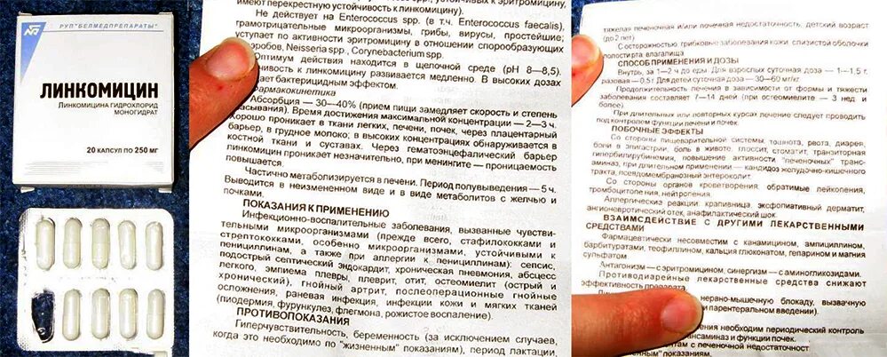 Препараты лечащие уреаплазму. Как лечить уреаплазмоз у женщин препараты схема. уреаплазма таблетки. лечение уреаплазма у женщин препараты схема. таблетки от уреаплазмоза для женщин.