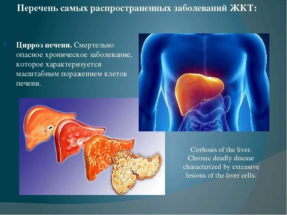 Болезни желудка список