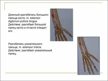 Длинный лучевой разгибатель запястья латынь