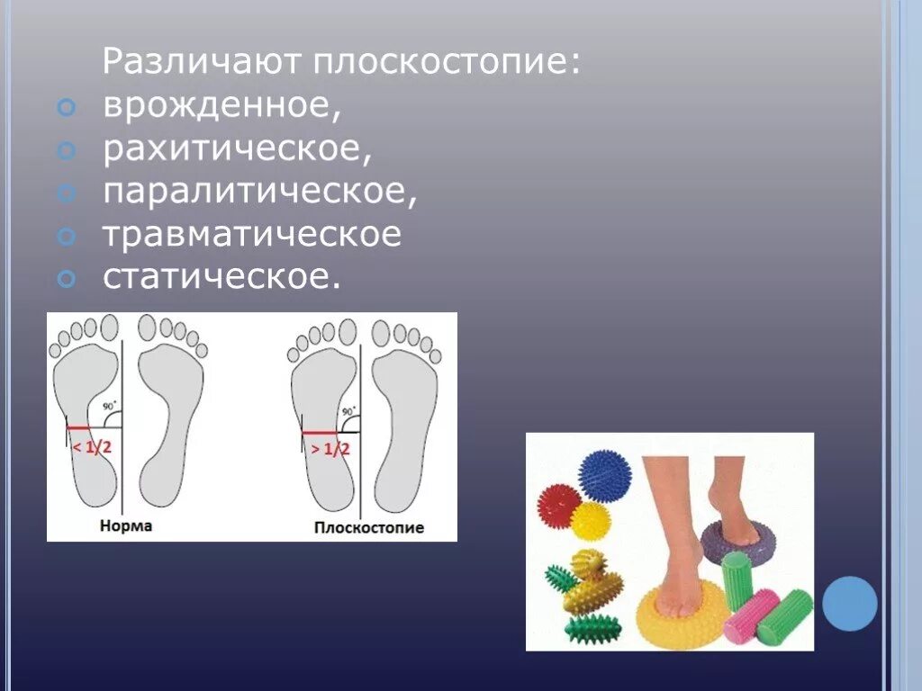 Чем может быть вызвано плоскостопие у человека. Плоскостопие. Профилактика плоскостопия. Врожденное плоскостопие. Профилактика нарушения плоскостопия.