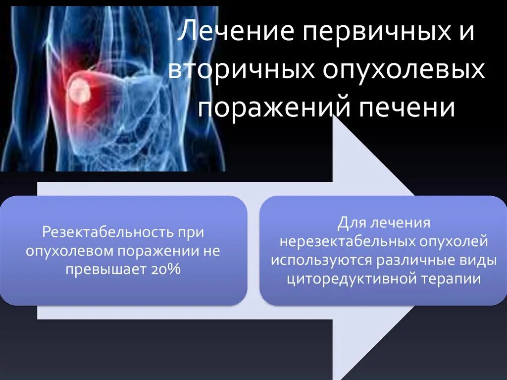 Первичные и вторичные поражения. Первичные и вторичные поражения печени. Опухолевые поражения печени. Вторичное поражение печени. Резектабельность злокачественных новообразований печени.