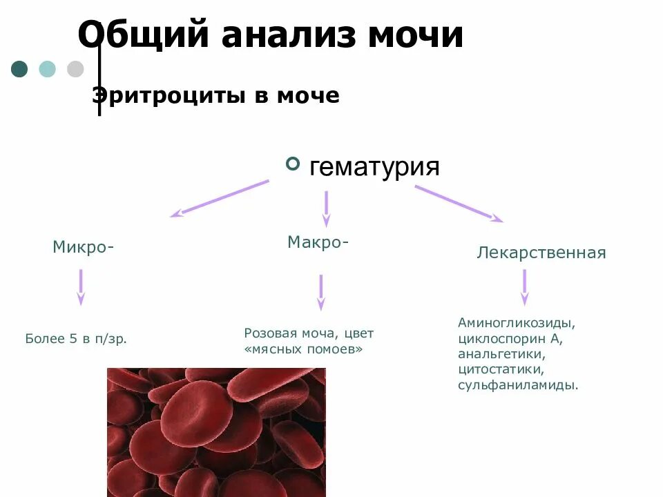 Гематурия гипертонический и отечный синдромы у детей