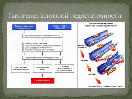 Острая венозная