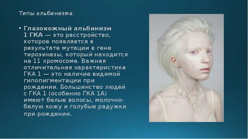 Глазокожный альбинизм 1 ГКА. Глазокожный альбинизм 4 типа. Наследственная болезнь альбинизм. Наследственные заболевания альбинизм кратко. Альбинизмом страдают