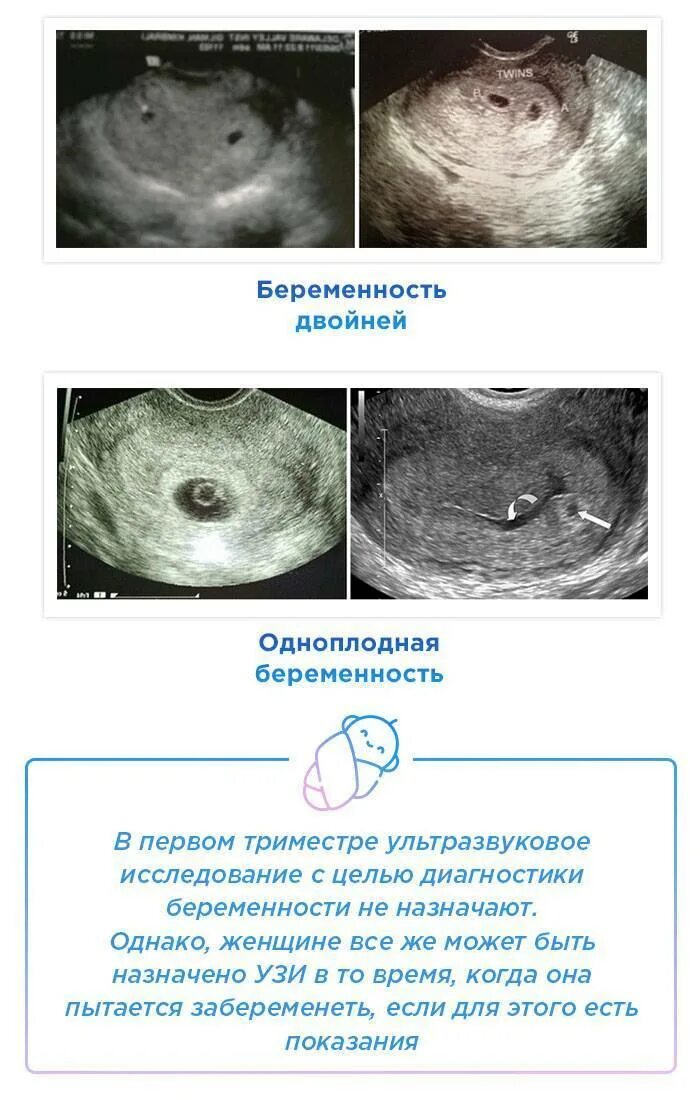 УЗИ 1-2 недели беременности на ранних сроках беременности. 1 Неделя беременности по УЗИ. УЗИ 1 неделя беременности замершей. Эмбрион на 1 неделе беременности УЗИ.