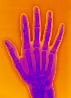 Hand 10