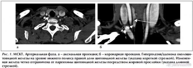 Почки. Стентография. Онкология почки от курения. Радионуклидная терапия. Радионуклидное исследование щитовидной железы.