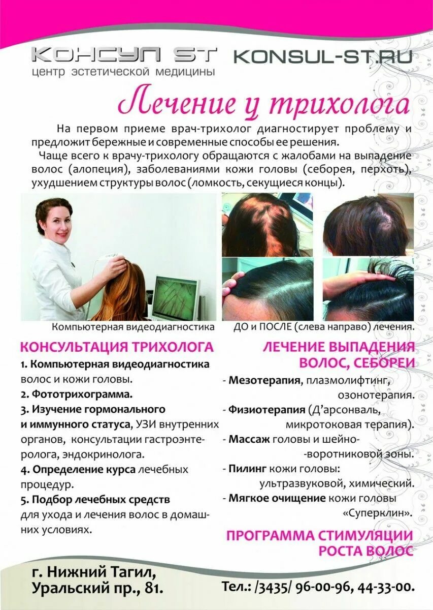 Трихолог для роста волос. Советы трихологов от выпадения волос. трихолог выпадение волос. трихолог волосы выпадают. средства от выпадения волос у женщин рекомендации трихологов.