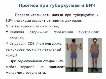 Сколько живете с вич