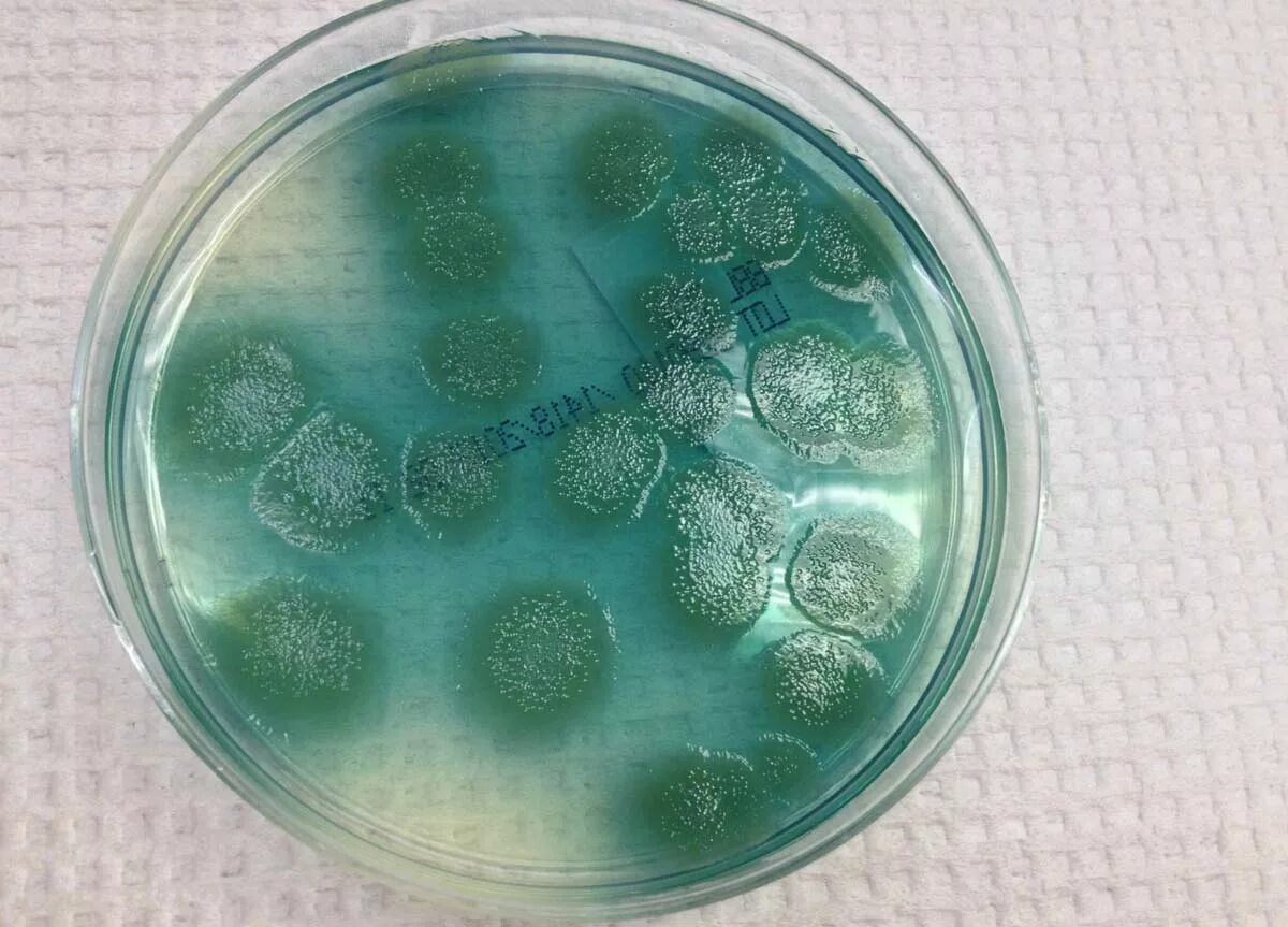 Пиоцианин Pseudomonas aeruginosa. Pseudomonas aeruginosa (синегнойная палочка). Pseudomonas aeruginosa на чашке Петри. Синегнойная палочка в чашке Петри.