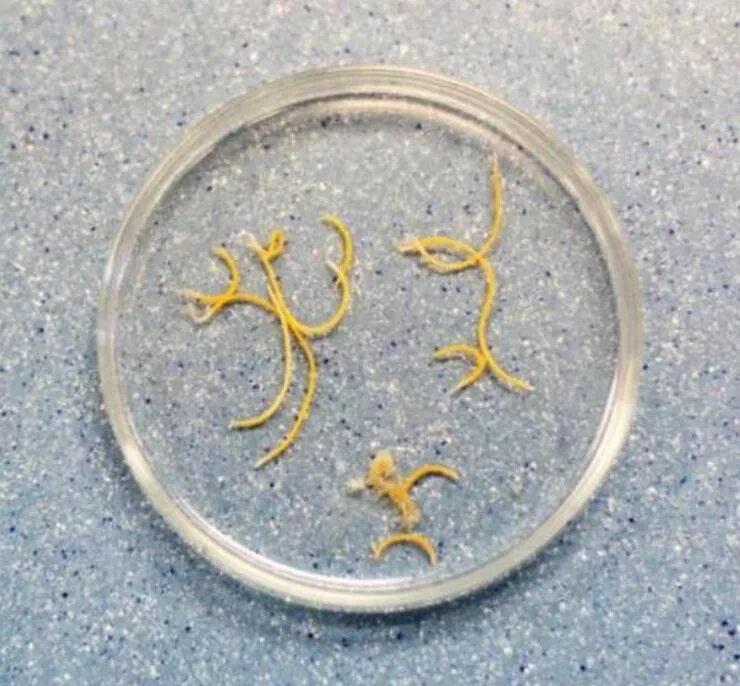 внешний вид аскариды человеческой. белые червячки острицы. гельминтоз энтеробиоз аскаридоз. маленькие аскариды. маленькие аскариды.