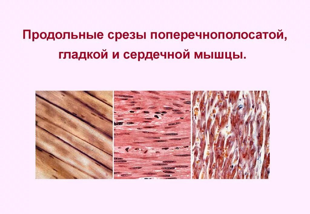 Сердечная мышца представлена тканью. Поперечно-полосатая гладкая Скелетная мышечная ткань. Поперечно-полосатая сердечная мышечная ткань гистология. Гладкая и поперечно полосатая мышечная ткань гистология. Гладкая и поперечнополосатая мышечные ткани гистология.