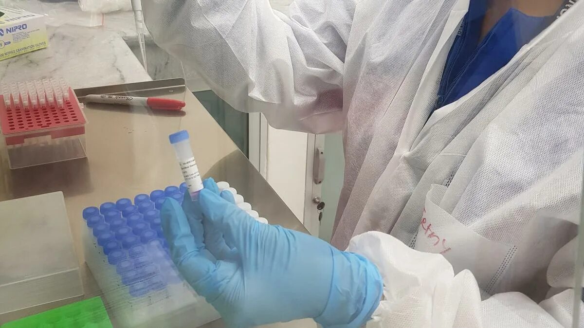 Выявленных случаев заражения коронавирусом. Рекорд заражения коронавирусом за сутки в россии. Вирусолог. Заражение коронавирусом. Выявленных случаев заражения коронавирусом.