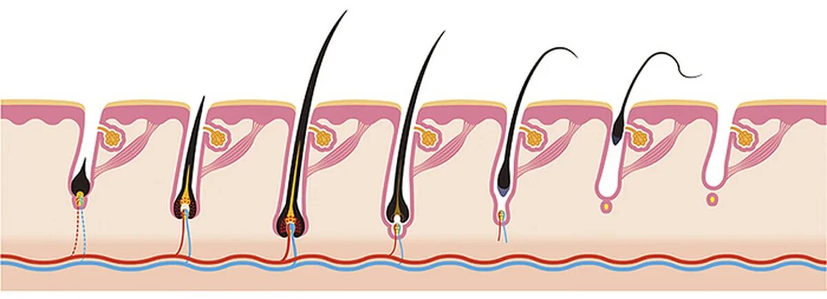 Корень волоса погружен в окруженную. Анаген катаген телоген. Волосяная луковица. Стадии роста волос. Фолликул волоса.