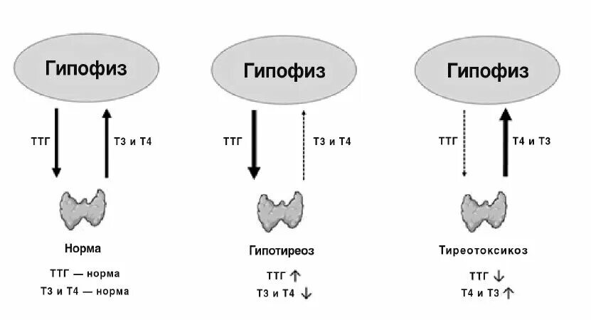 Т т х и ответы. Гипотиреоз показатель ТТГ норма. Гипотиреоз гормоны ТТГ И т4. Гипотиреоз показатели гормонов щитовидной железы. Гипотиреоз норма ТТГ И т4.