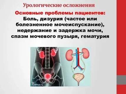 Вопросы детскому урологу