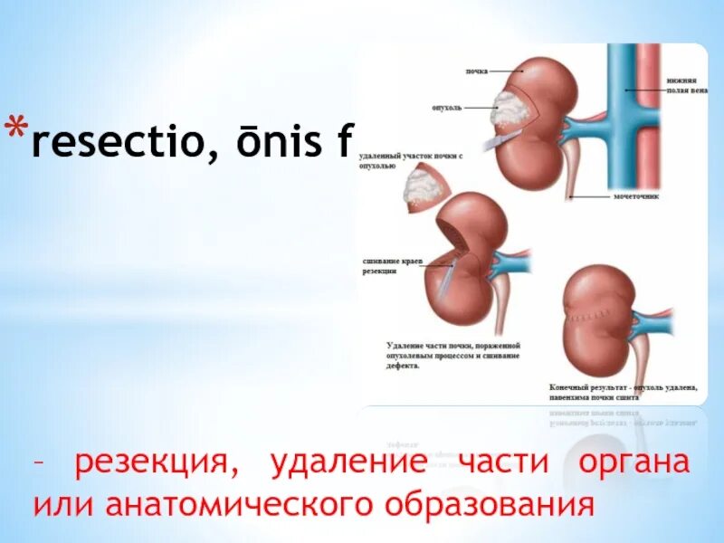 Хирургический латынь. Удаление части органа (резекция. Resectio латынь. Название хирургических операций на латыни.