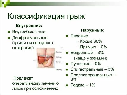 Признаки грыжи у взрослых