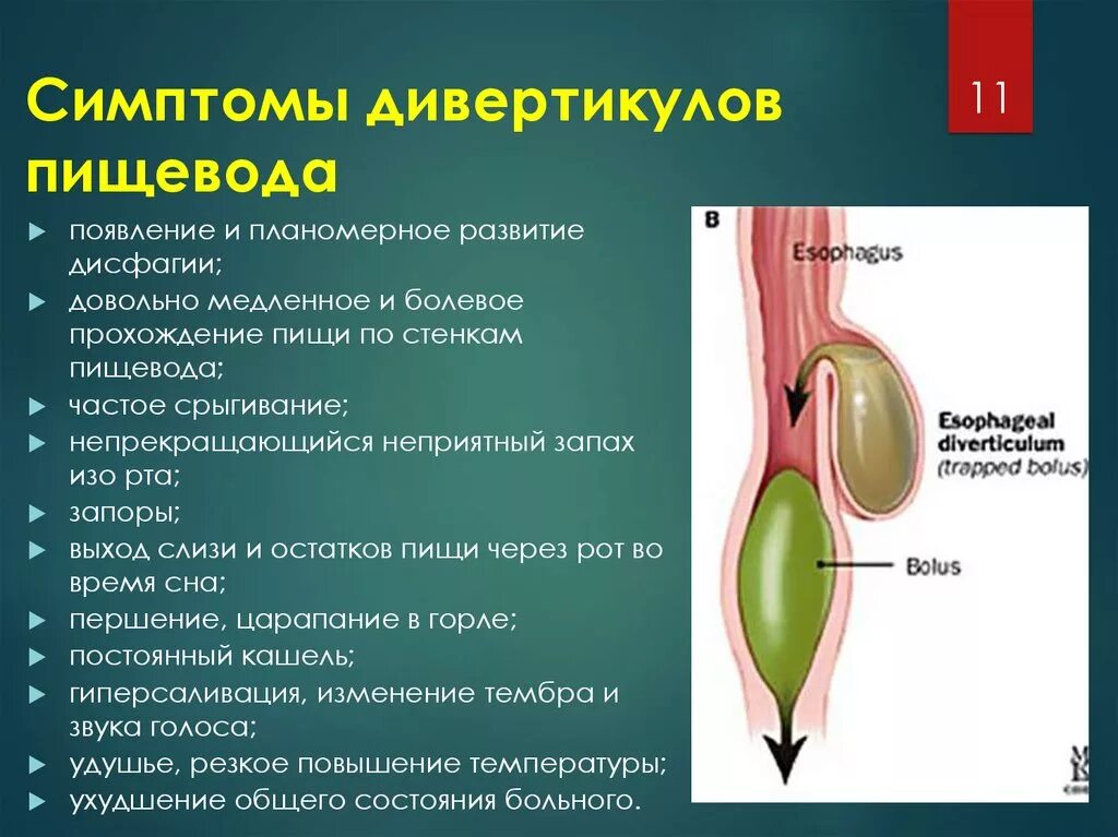 Пищевода лечится