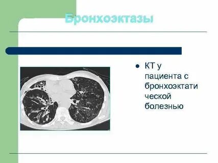 Пороки бронхолегочной системы