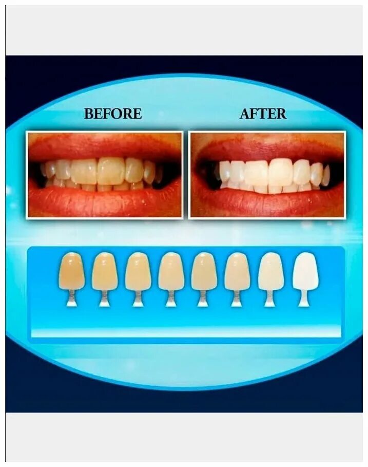 Естественный цвет зубов. Шкала вита а1 виниры. Шкала вита блич. Шкала вита а1. Шкала вита а2.
