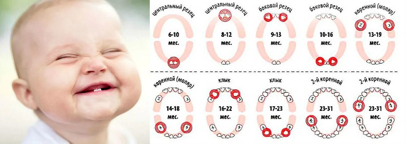 Сколько дней ребенок. Зубки у малышей порядок прорезания по месяцам. Какие зубки 1 вылезают у младенцев. Зубы у детей порядок прорезывания и Возраст. Когда какие зубы режутся у детей.