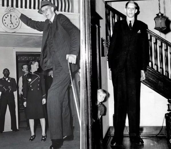 Роберт першинг уодлоу рост. Роберт уодлоу рост 272 см. Болезни высоких людей. Султан кёсен и екатерина лисина. Болезни высоких людей.