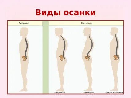 Осанка 1