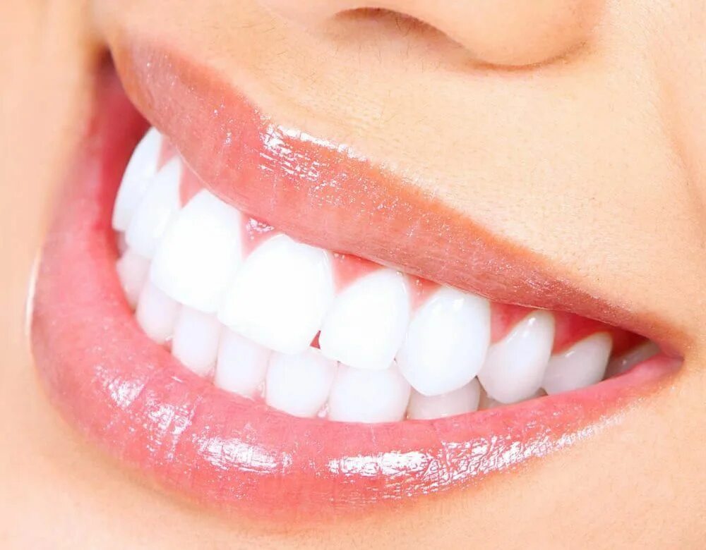 Smile design. Smile design