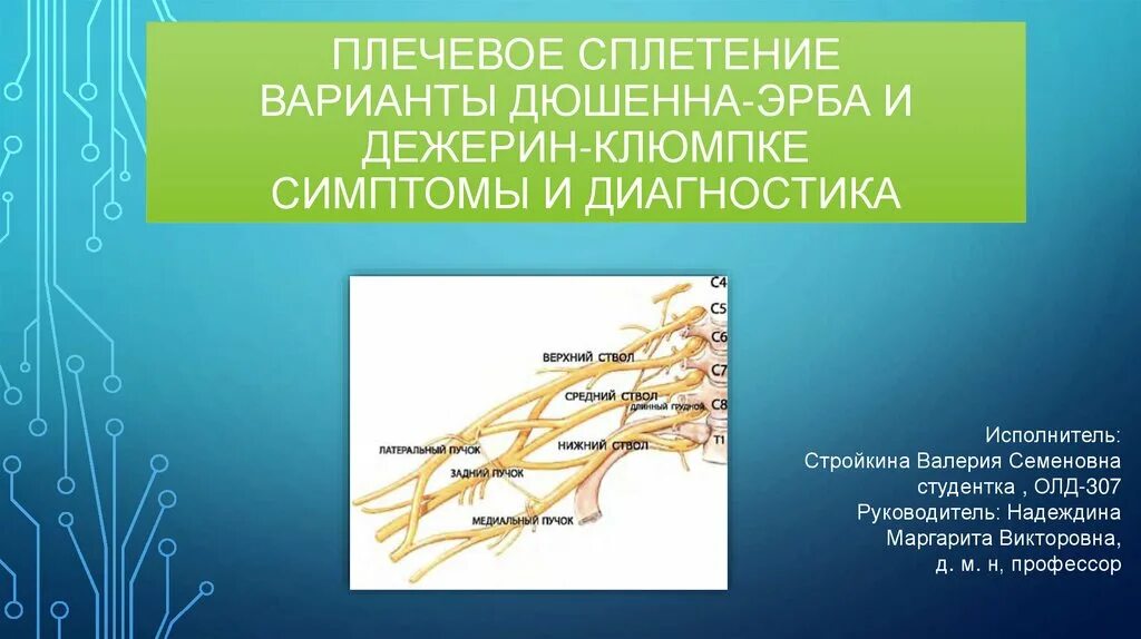 Поражение плечевого сплетения. Поражение нервов плечевого сплетения. Поражение ствола плечевого сплетения. Синдром поражения среднего ствола плечевого сплетения.