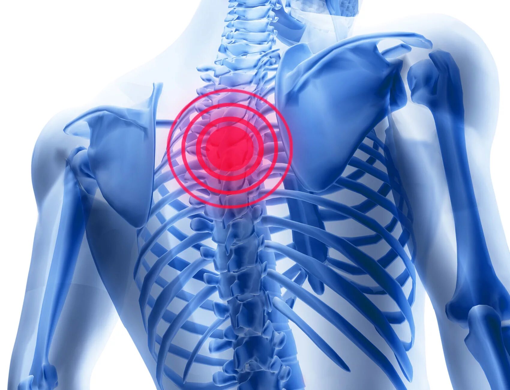 Остеохондроз с правой стороны. Боль в спине остеохондроз. Грудной остеохондроз. Остеохондроз грудной клетки.
