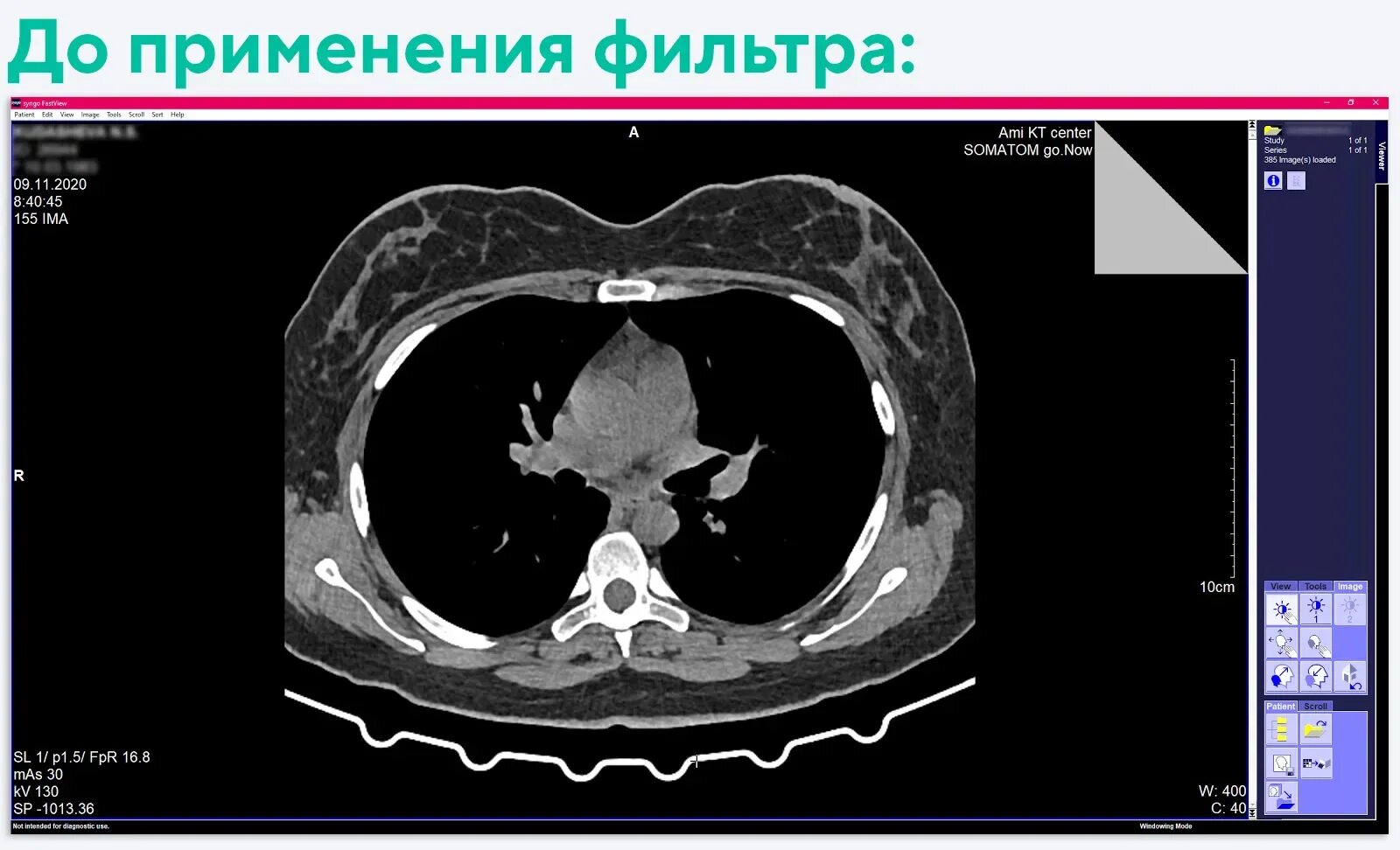 Компьютерная томография изображение. Реконструкция кт изображений. Реконструкция и воспроизведение изображения кт. Принцип формирования кт изображения.