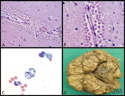 Амеба naegleria