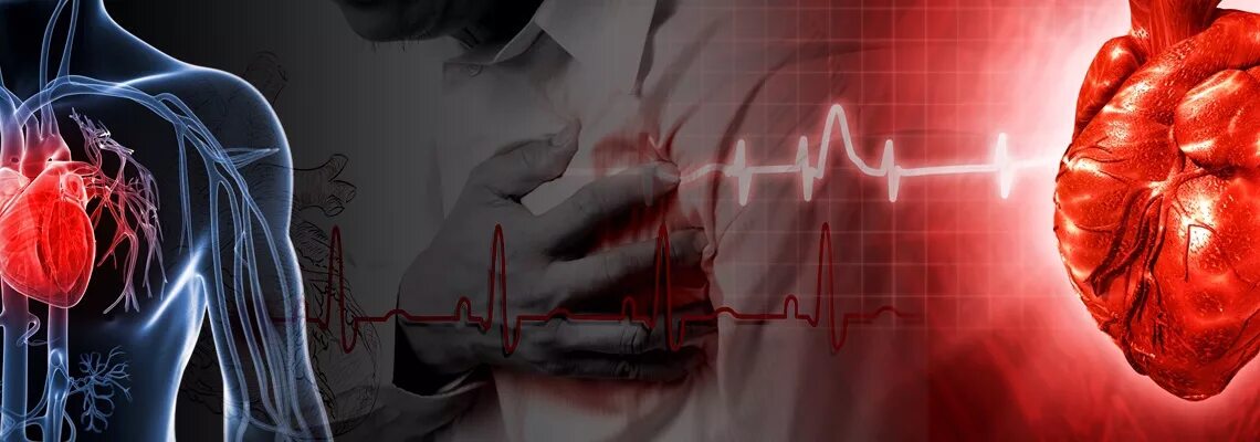 Коронарная ишемия. ИБС (коронарная болезнь сердца). Острая сердечная недостаточность(инфаркт миокарда,стенокардия). Ишемия инфаркт миокарда. Ишемическая болезнь сердца поражение миокарда.