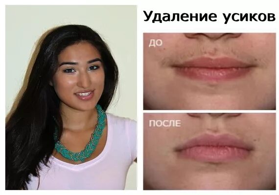 Как убрать усы у девушки пинцетом не больно. Убрать щетину в фотошопе. Убрать бороду в фотошопе. Приложение убрать усы. Приложение убрать усы.