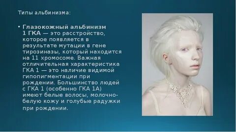 Альбиносы процент