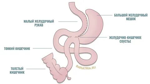 Бариатрическая операция уфа