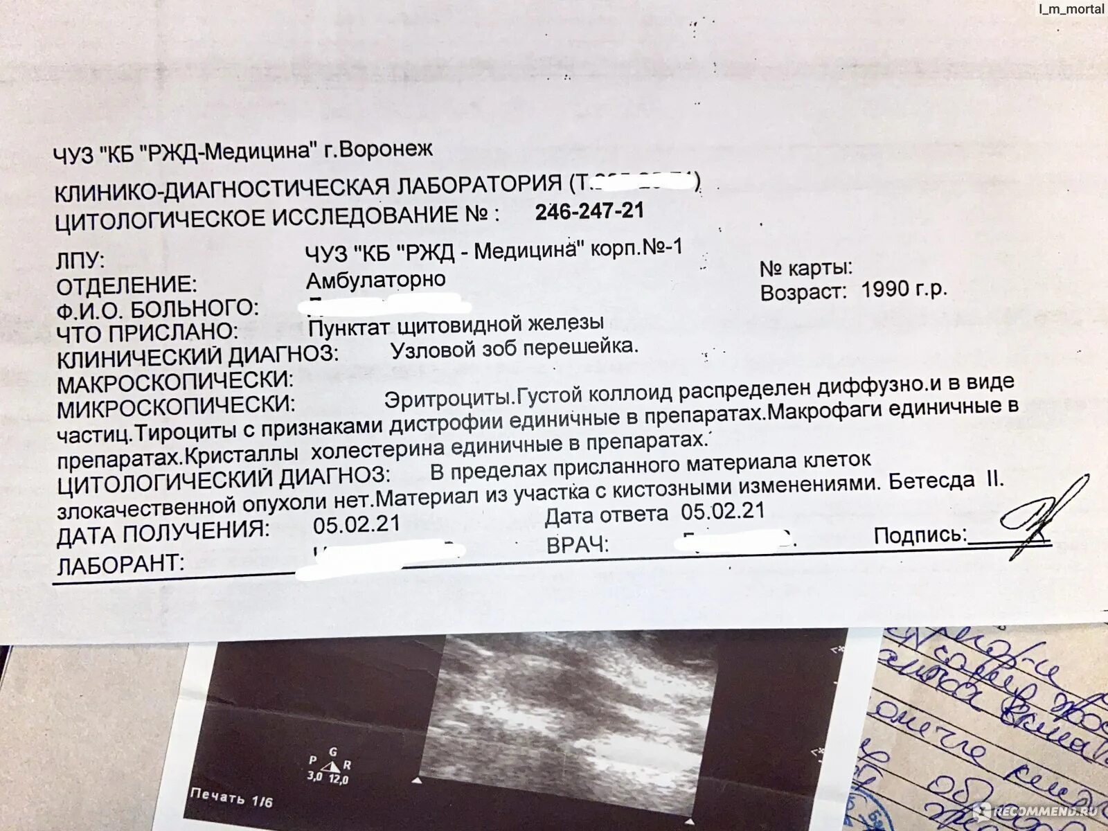 Биопсия узла щитовидной железы результаты. Результат биопсии молочной железы. Биопсия молочной железы отзывы форум. Биопсия молочной железы анализ. Показатели биопсии молочной железы.