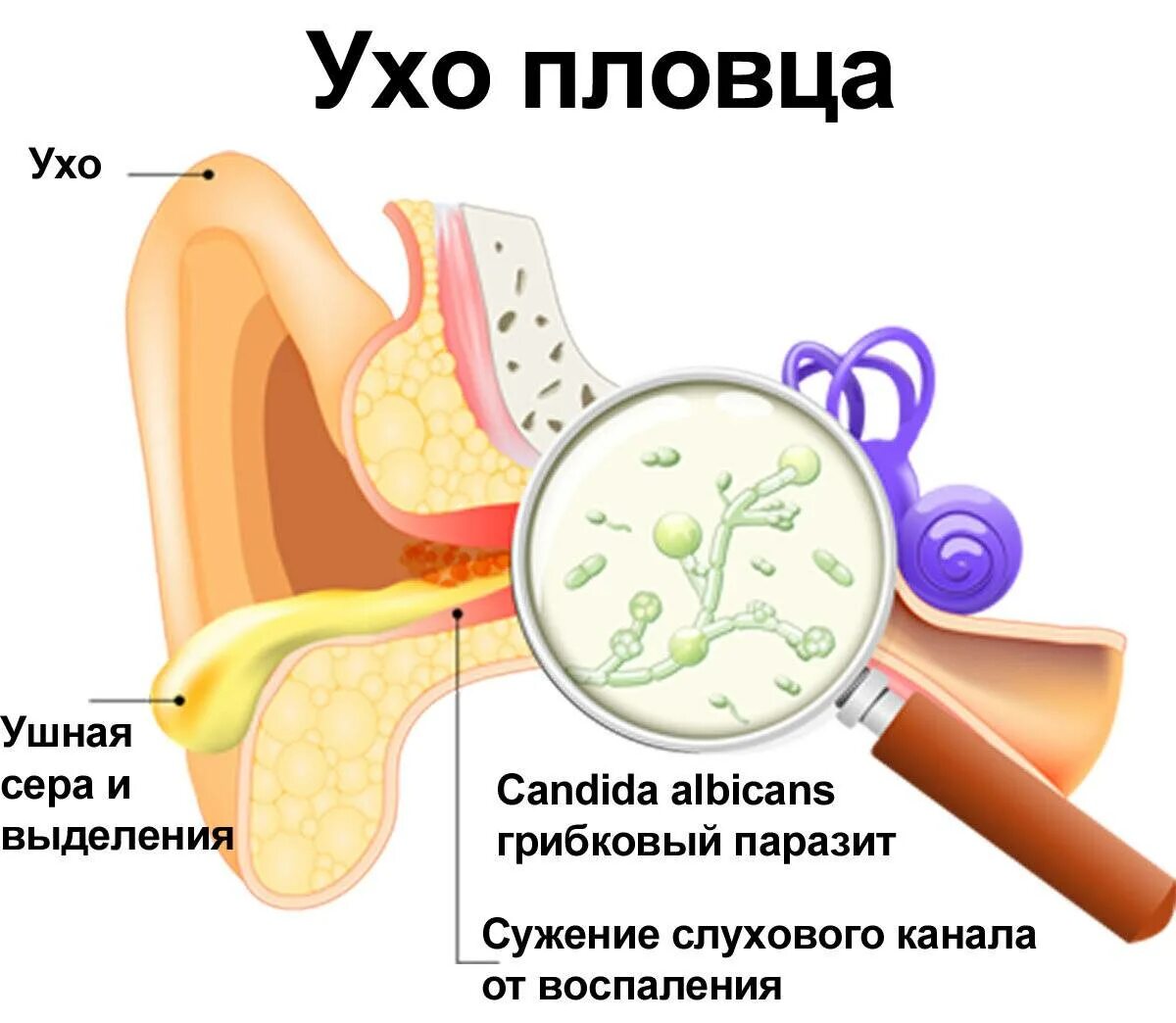 После высмаркивания заложило ухо. Если вода попала в среднее ухо.