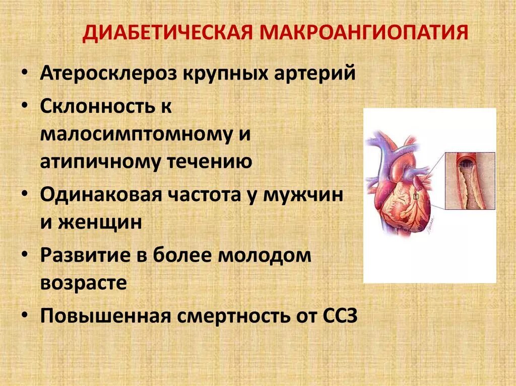 Микроангиопатия и макроангиопатия. Диабетическая микроангиопатия. Макроангиопатия сосудов при сахарном диабете. Диабетическая макроангиопатия атеросклероз. Макроангиопатия что это такое