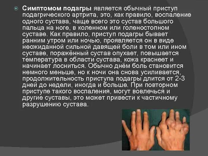 Подагра причины возникновения. Подагра признаки и симптомы. основные проявления подагры.