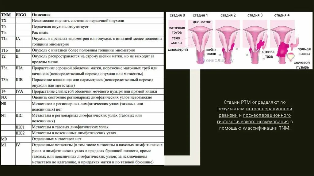 Что значит рак матки. Степени онкологии шейки матки. Опухоли тела матки классификация. Классификация TNM опухолей матки.