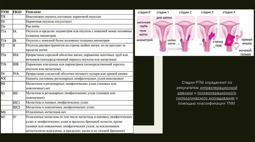 Осложнения рака матки. Степени онкологии шейки матки. Опухоли тела матки классификация. Классификация TNM опухолей матки.