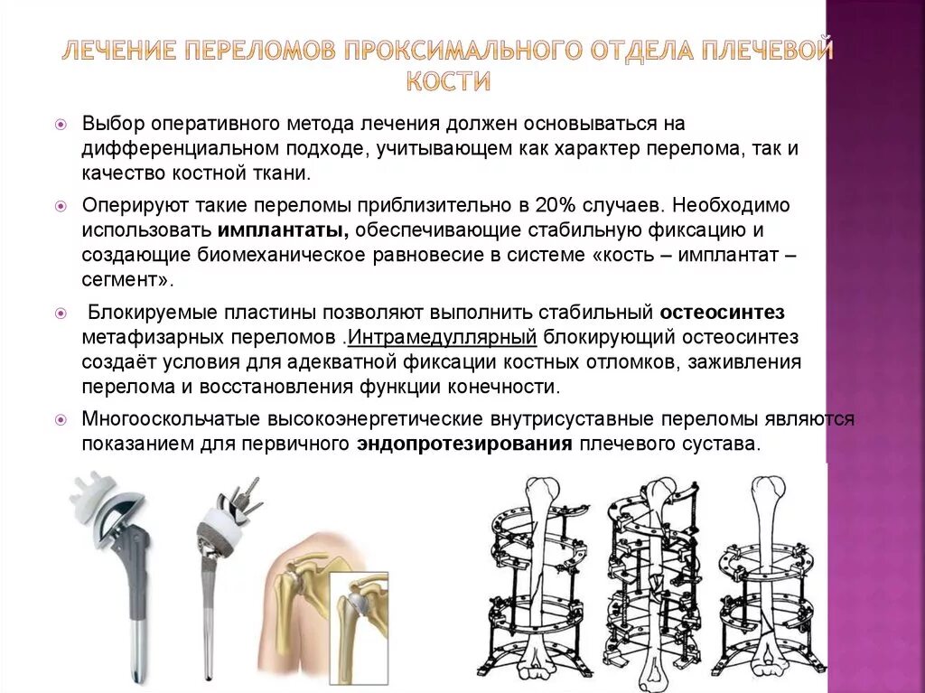 Оперативное лечение перелома костей. Остеосинтез переломов дистального отдела плечевой кости. Методы оперативного лечения переломов плечевой кости. Методики лечения переломов плечевой кости. Принципы оперативного лечения переломов.