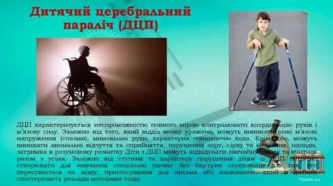 Дцп презентация