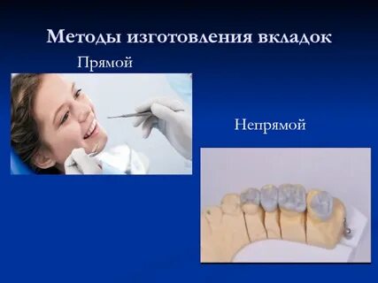 Изготовление вкладок